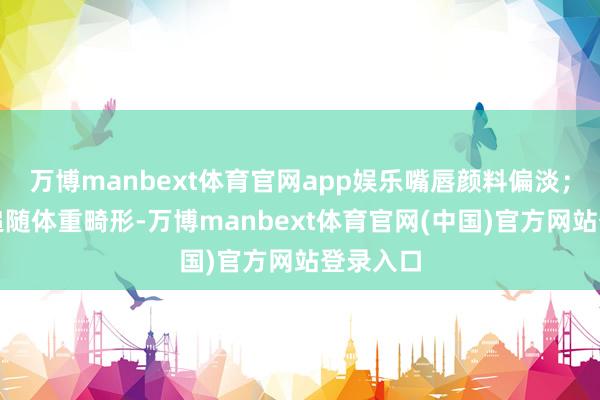 万博manbext体育官网app娱乐嘴唇颜料偏淡；还可能追随体重畸形-万博manbext体育官网(中国)官方网站登录入口
